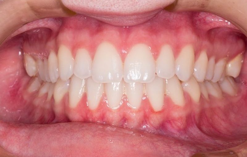 denti-sani_800x532